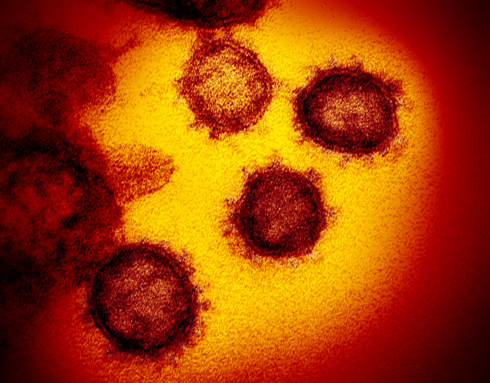 This transmission electron microscope image shows SARS-CoV-2—also known as 2019-nCoV, the virus that causes COVID-19. isolated from a patient in the U.S., emerging from the surface of cells cultured in the lab. Credit: NIAID-RML
